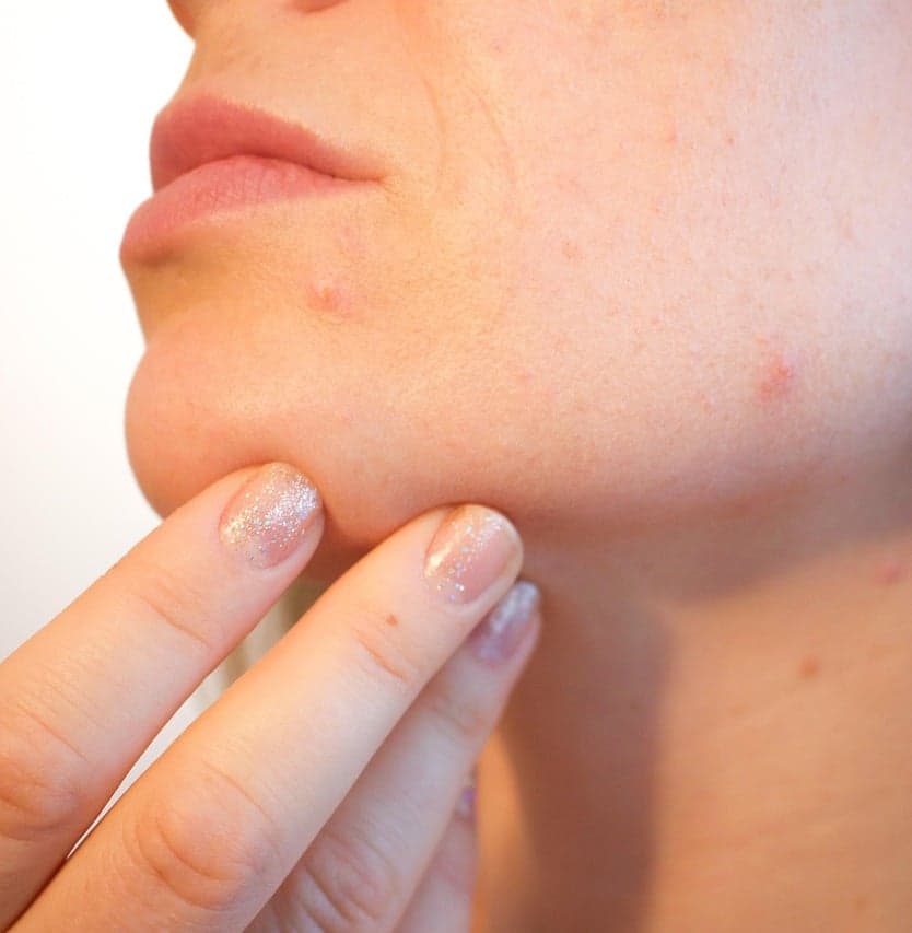 Before and after treatment result 2